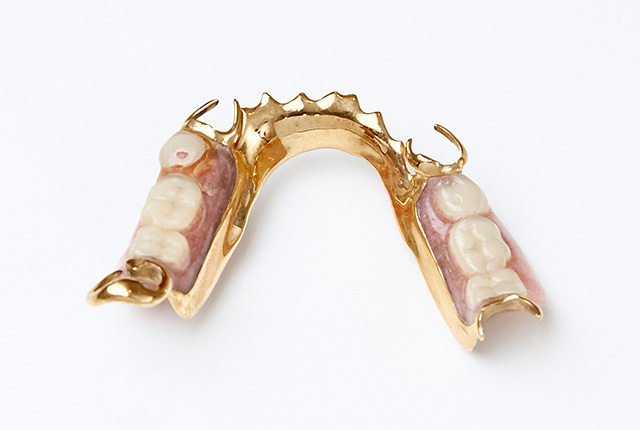 プラチナ床義歯