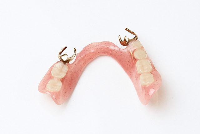 18Kクラスプ義歯
